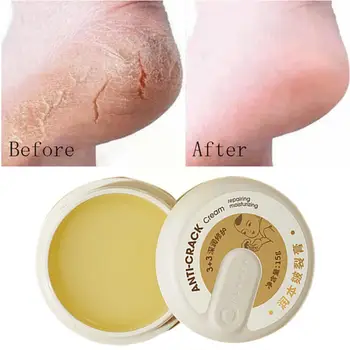 15g Pele Rachada Reparação de Creme Anti-Fissuras Pé Creme de Pés Pele Seca Pele de Inverno Rachado Cuidados de Reparação Suaviza a Pele Moisturiz C8K9