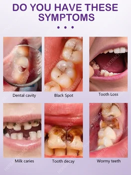 Anti-cavidade de cárie dentária fresco mau hálito reparação de cárie dental remove a placa aliviar a dor de dente periodontite