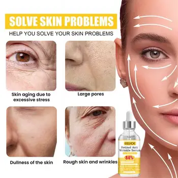Anti-idade Creme facial Remover Rugas de Levantamento de Soro Idade Linhas de Anti-envelhecimento E Rugas Faciais Removedor do Enrugamento do Mulheres Homens